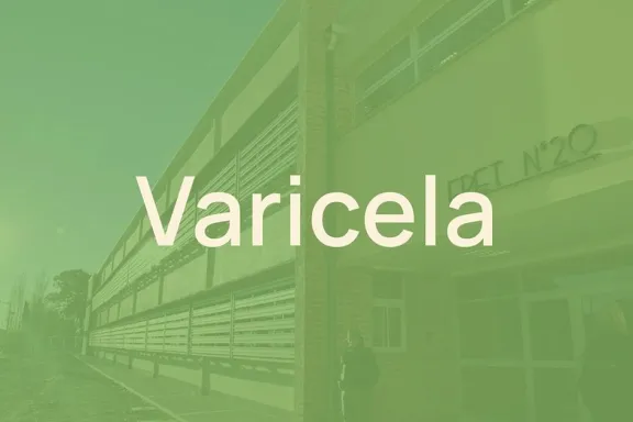 salud-y-educacion-cierran-cerco-a-dos-brotes-de-varicela-en-